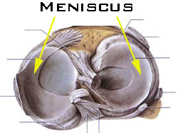 Meniscus03.jpg